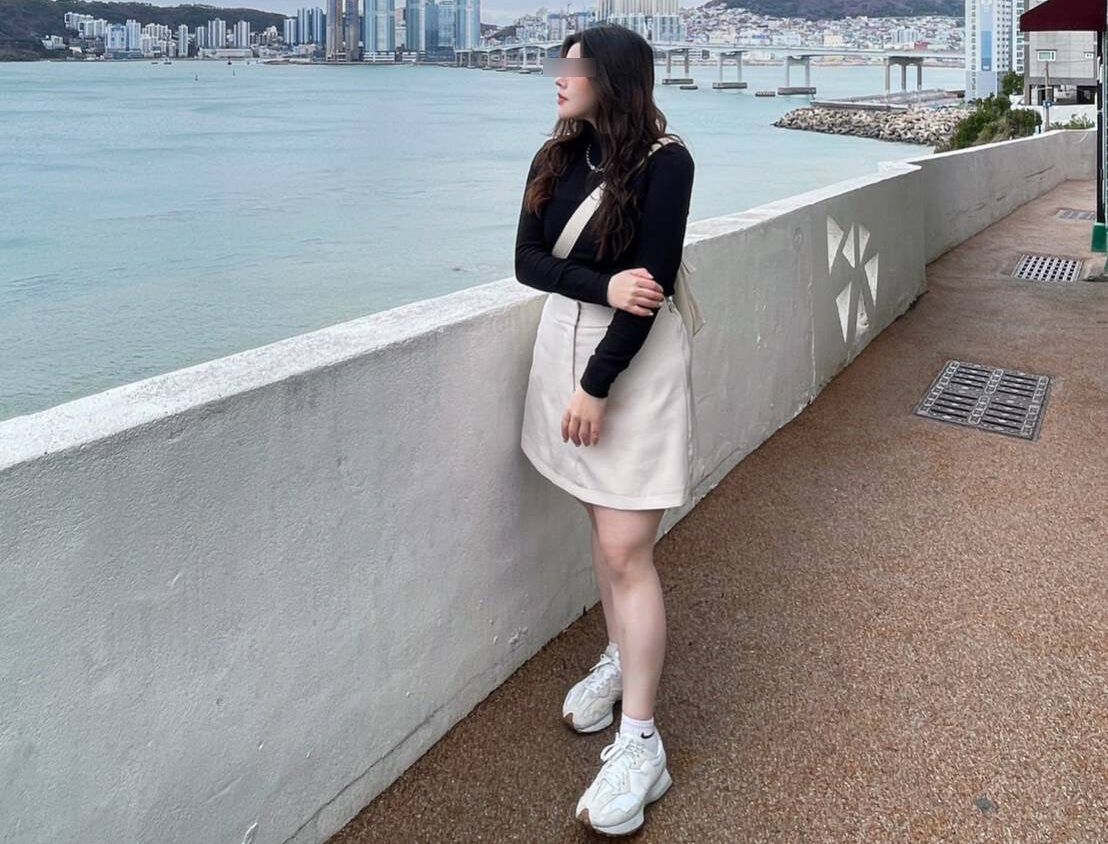 24歲黃小姐成功減重50公斤  羅東博愛醫院微創手術見效！