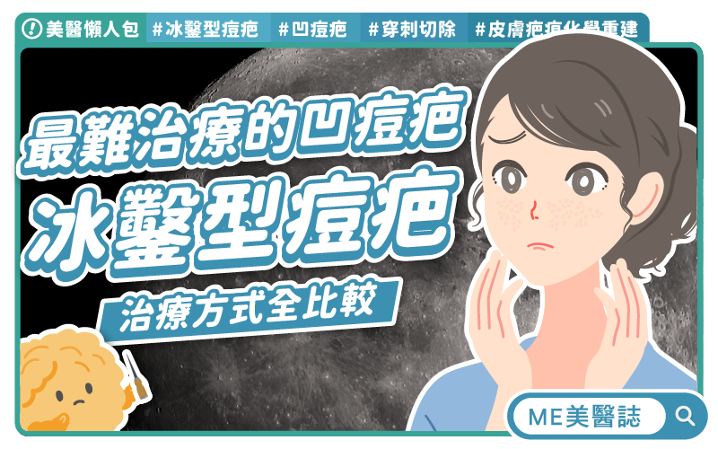 凹痘疤不再絕望 專家解析複合式治療
