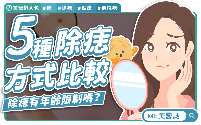痣可能暗藏危機？醫師教你五招辨識惡性痣！