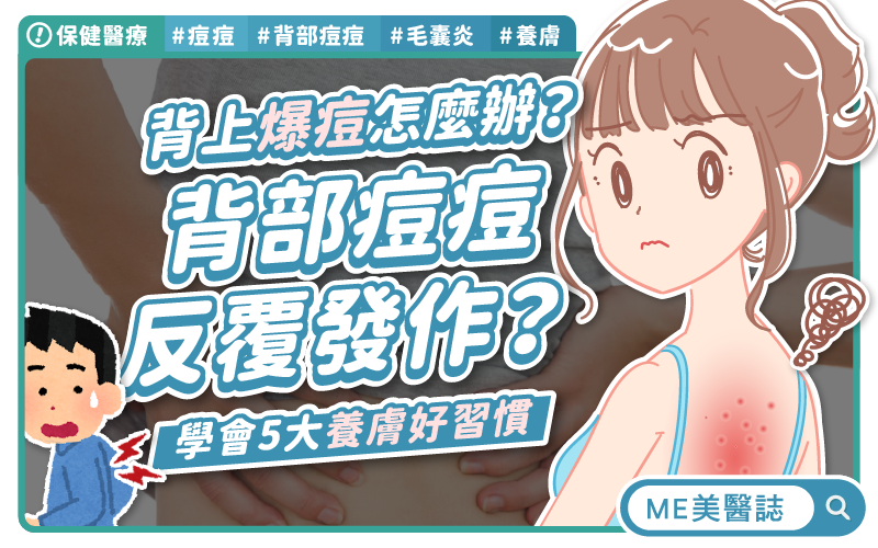 濕熱肌警報！你的背痘是「痘」還是「炎」？