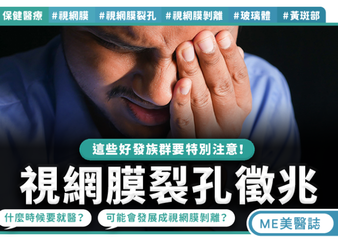 飛蚊突增閃光警訊  視網膜裂孔恐剝離
