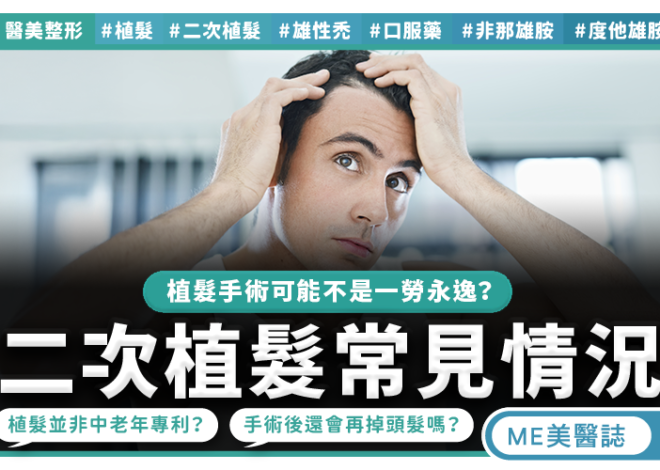 移植後頭髮還會掉 二次評估三大重點