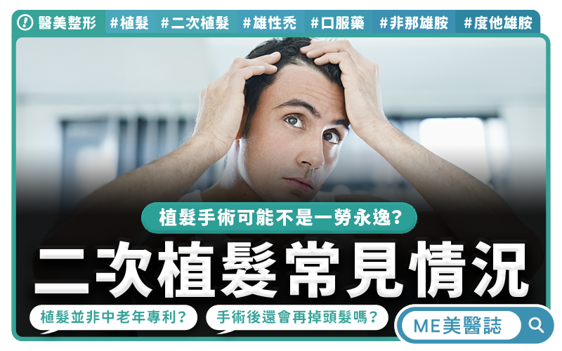 移植後頭髮還會掉 二次評估三大重點